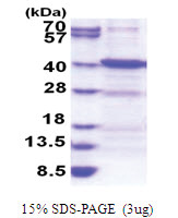 ANKRA2 (1-313, His-tag) Human Protein