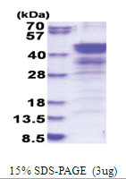 NDEL (1-328, His-tag) Human Protein
