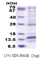LAMTOR4 (1-99, His-tag) Human Protein