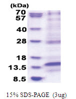 LAMTOR4 (1-99, His-tag) Human Protein