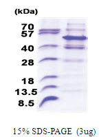 PELI2 (1-420, His-tag) Human Protein