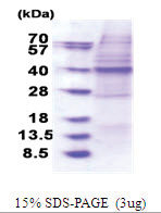 OSGEP / GCPL1 (His-tag) Human Protein