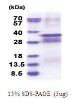 OSR2 (His-tag) Human Protein