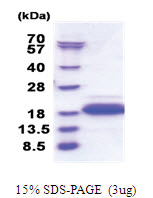 DPY30 (1-99, His-tag) Human Protein