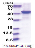 G protein alpha Q / GNAQ (1-359, His-tag) Human Protein