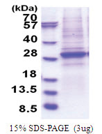 SMARCA4 (362-549, His-tag) Human Protein