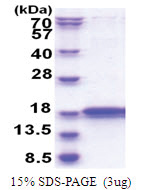 IMMP2L (38-175, His-tag) Human Protein