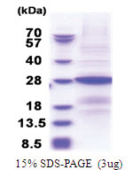 B9D1 (1-204, His-tag) Human Protein