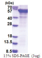 PCID2 (80-399, His-tag) Human Protein