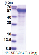 PCID2 (80-399, His-tag) Human Protein