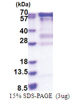RNGTT / HCE (1-597, His-tag) Human Protein