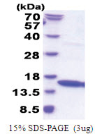 IFNG / Interferon gamma (24-161) Human Protein