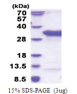 TSR2 (1-190, His-tag) Human Protein