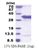 TSR2 (1-190, His-tag) Human Protein