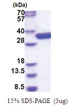 glk (1-321, His-tag) Escherichia coli Protein