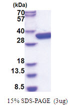 glk (1-321, His-tag) Escherichia coli Protein