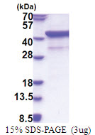 CD172a / SIRPA (27-373, His-tag) Human Protein