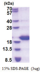 Lipocalin-1 (19-176, His-tag) Human Protein