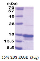 PTRHD1 (1-140, His-tag) Human Protein
