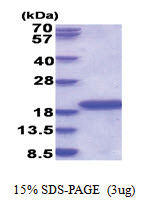 IL1F5 / IL1L1 (1-155, His-tag) Human Protein