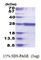 RAB39B (1-213, His-tag) Human Protein