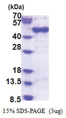 Arfaptin-1 (1-373, His-tag) Human Protein