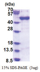 Arfaptin-1 (1-373, His-tag) Human Protein