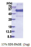 KLF12 (1-402, His-tag) Human Protein