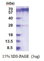 PREP / PEP (1-710, His-tag) Human Protein