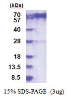 PREP / PEP (1-710, His-tag) Human Protein