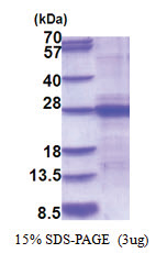Interleukin-6 / IL6 (25-211, His-tag) Mouse Protein