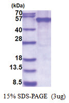 EDAR (27-448, His-tag) Human Protein