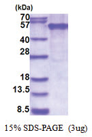 EDAR (27-448, His-tag) Human Protein