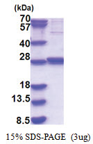 GLTPD1 (1-214, His-tag) Human Protein