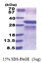 Lysyl oxidase (169-417, His-tag) Human Protein