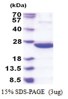 idnk (1-187, His-tag) Escherichia coli Protein