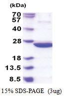 idnk (1-187, His-tag) Escherichia coli Protein