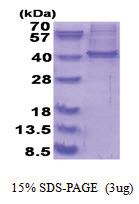 RALY (1-306, His-tag) Human Protein