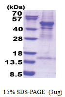 ACTR3 (1-418, His-tag) Human Protein