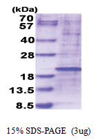 RPL35 (1-123, His-tag) Human Protein