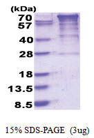 EEF-2 kinase (1-725, His-tag) Human Protein