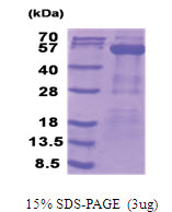 PDHX / PDX1 (54-501, His-tag) Human Protein