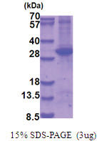 MAP2K6 (53-314, His-tag) Human Protein