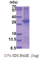 MAP2K6 (53-314, His-tag) Human Protein