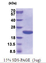ppiA 25-190aa (His-tag) Human Protein ppiA 25-190aa (His-tag) Human Protein