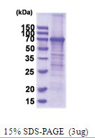 CD71 / TFRC (89-760, His-tag) Human Protein CD71 / TFRC (89-760, His-tag) Human Protein