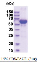 SUOX (80-545, His-tag) Human Protein SUOX (80-545, His-tag) Human Protein