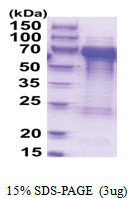 TOM1L2 (1-507, His-tag) Human Protein TOM1L2 (1-507, His-tag) Human Protein