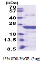 CLEC4E (41-219, His-tag) Human Protein CLEC4E (41-219, His-tag) Human Protein