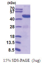 Phosphoglycerate kinase 1 (PGK1) (1-4170, His-tag) Mouse Protein Phosphoglycerate kinase 1 (PGK1) (1-4170, His-tag) Mouse Protein
